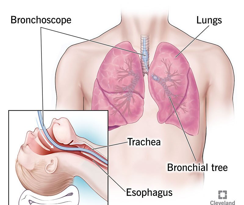 Breathing Life into Pulmonary Care